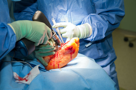 Surgeons working on a patient- foot in a operating theaterの写真素材
