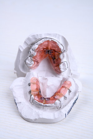 removable  brances and plaster model  on bright groundの写真素材