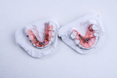 removable  brances and plaster model  on bright groundの写真素材