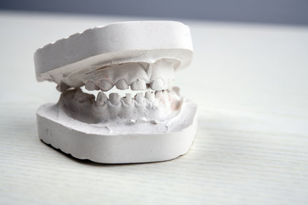 plaster model  of teeth on bright groundの写真素材