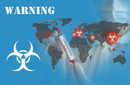 Doctor wearing a medical face mask and gloves, holding a blood test result for the Coronavirus COVID-19 pandemic rapidly spreading. Coronavirus in the world conceptual photo.の写真素材