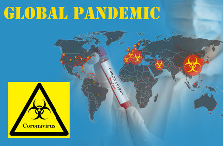 Doctor wearing a medical face mask and gloves, holding a blood test result for the Coronavirus COVID-19 pandemic rapidly spreading. Coronavirus in the world conceptual photo.の写真素材