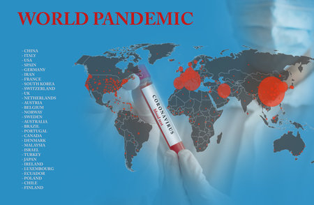 Doctor wearing a medical face mask and gloves, holding a blood test result for the Coronavirus COVID-19 pandemic rapidly spreading. Coronavirus in the world conceptual photo.の写真素材