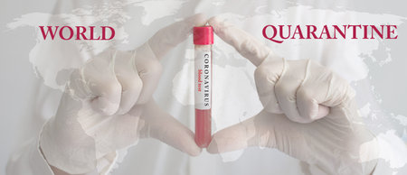 Coronavirus conceptual photo with doctor hands wearing medical gloves holding a blood test result for the COVID-19 pandemic and world map, blurred backgroundの写真素材