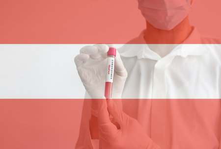 Coronavirus conceptual photo with doctor wearing a medical face mask and gloves, holding a blood test result for the COVID-19 pandemic and national flag of Austria, blurred backgroundの写真素材