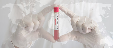 Coronavirus conceptual photo with doctor hands wearing medical gloves holding a blood test result for the COVID-19 pandemic and world map, blurred backgroundの写真素材