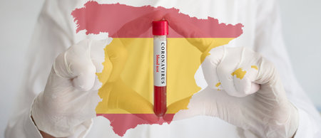Coronavirus conceptual photo with doctor hands wearing medical gloves holding a blood test result for the COVID-19 pandemic and national flag of Spain, blurred backgroundの写真素材