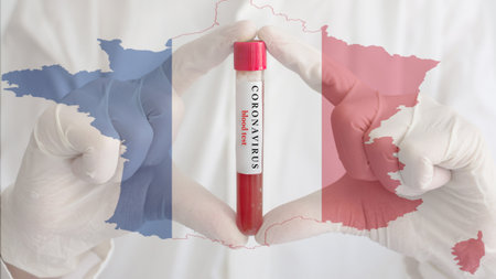 Coronavirus conceptual photo with doctor hands wearing medical gloves holding a blood test result for the COVID-19 pandemic and national flag of France, blurred backgroundの写真素材