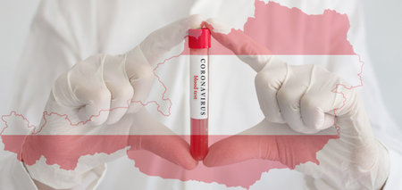 Coronavirus conceptual photo with doctor hands wearing medical gloves holding a blood test result for the COVID-19 pandemic and national flag of Austria, blurred backgroundの写真素材
