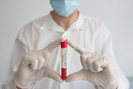 Doctor wearing a medical face mask and gloves, holding a blood test result for the Coronavirus COVID-19 outbreak. Coronavirus blood test conceptual photo.の写真素材