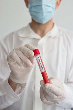 Doctor wearing a medical face mask and gloves, holding a blood test result for the Coronavirus COVID-19 outbreak. Coronavirus blood test conceptual photo.の写真素材