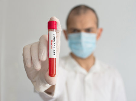 Doctor wearing a medical face mask and gloves, holding a blood test result for the Coronavirus COVID-19 outbreak. Coronavirus blood test conceptual photo.の写真素材