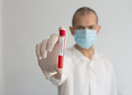 Doctor wearing a medical face mask and gloves, holding a blood test result for the Coronavirus COVID-19 outbreak. Coronavirus blood test conceptual photo.の写真素材