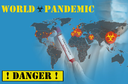 Doctor wearing a medical face mask and gloves, holding a blood test result for the Coronavirus COVID-19 pandemic rapidly spreading. Coronavirus in the world conceptual photo.の写真素材