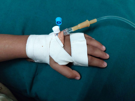 Hospitalize Patient hand with Iv set and plasterの写真素材