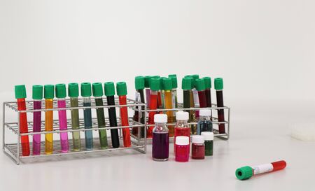 The testing or investigating of vaccine to inhibit the coronavirus (COVID-19) clinical trial phase in vitro microbiology laboratory, blood reagent experiment for Anti-virus cause of disease spreading.の写真素材
