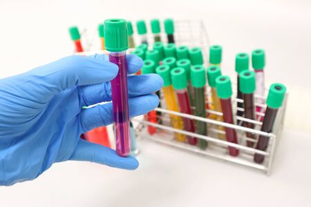 Cell-culture tube with purple solvent or solution handle in hands wear nitrile blue gloves, with colorful culture cell tubes cover with green caps, biotechnology analysis experiment for anti-virus.の写真素材