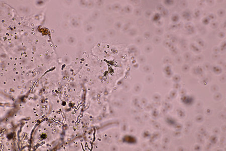 Characteristics of Aspergillus (Aspergillus) under microscope view for education in laboratory.