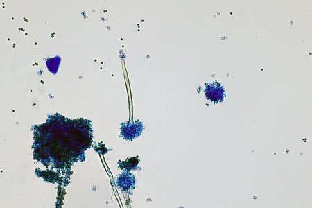 Microscope of black fungus spore strain with Lactophenol cotton blue, molds or yeasts with macro 40x...