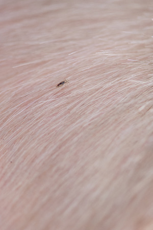 Head louse, insect, on head and on blond hair