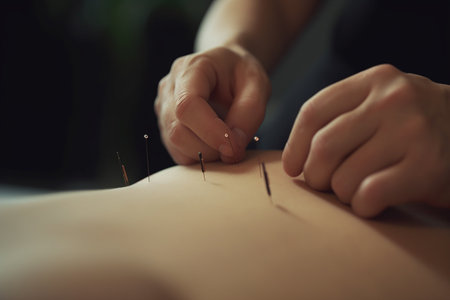 Acupuncture treatment with needles inserted into skin, hands resting on topの素材