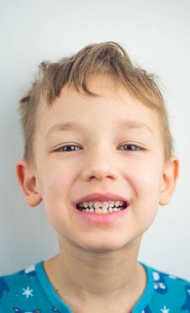 Portrait of a boy in pajamas, bad teeth, closeup.