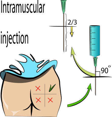 ILLUSTRATION OF RULES INTRAMUSCULAR INJECTIONのイラスト素材