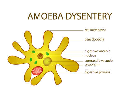 ILLUSTRATION OF AMOEBA DYSENTERY. microbiology. intestinal infectionのイラスト素材