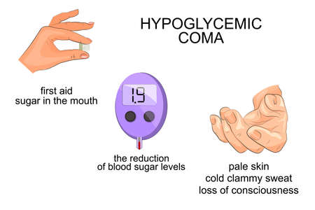 illustration of symptoms and hypoglycemic coma. infographicsのイラスト素材