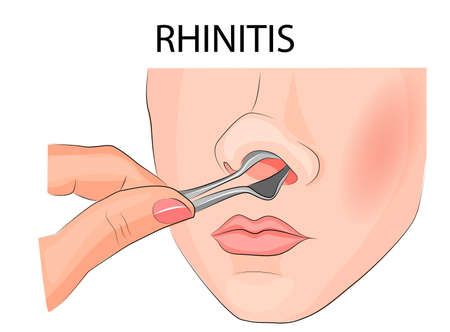 illustration of inspection of the nasal cavityのイラスト素材