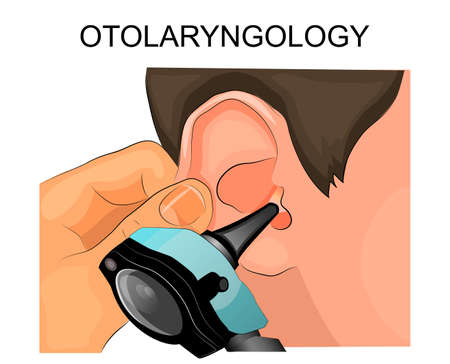 illustration of the diagnosis of diseases of the ear using the Otoscope. otolaryngologyのイラスト素材