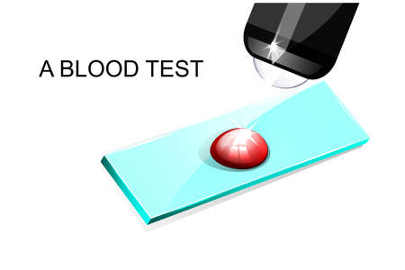 illustration of a blood drop on a slide under a microscopeのイラスト素材