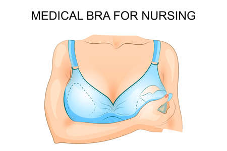 illustration of a medical bra for nursing. breast-feedingのイラスト素材