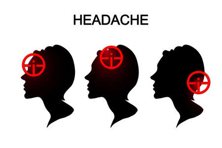 illustration of headache in women. migraine.のイラスト素材