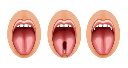 illustration of a split tongue and fangs graftのイラスト素材