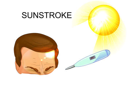 vector medical illustration of the overheating of the human body. heat strokeのイラスト素材
