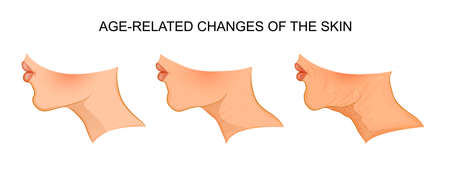 vector illustration of age-related changes. aging. for publications in medical journalsのイラスト素材