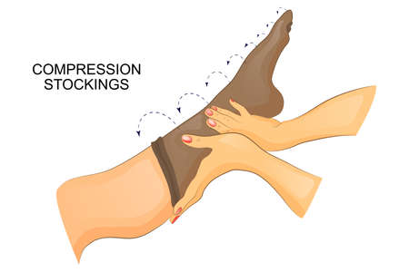 vector illustration of dressing compression stocking on the leg.のイラスト素材