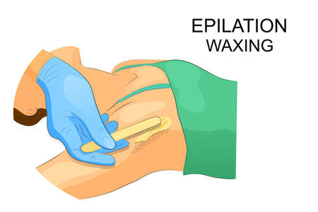 vectory illustration of waxing the hair from the armpitsのイラスト素材