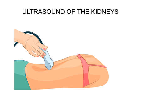 vector illustration of an ultrasound of the kidneysのイラスト素材