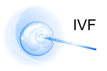 vector illustration of artificial insemination. the egg and spermのイラスト素材