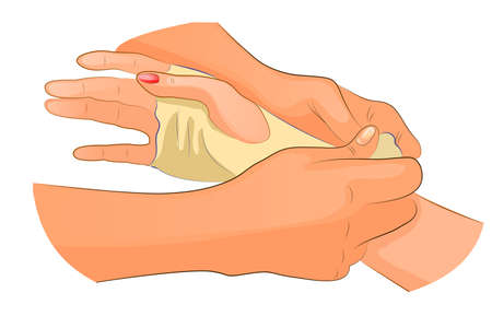 vector illustration of a bandage in case of injury of wrist jointのイラスト素材