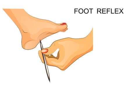 vector illustration of reflexes of the foot.のイラスト素材