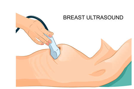 Illustration of a breast ultrasound.のイラスト素材