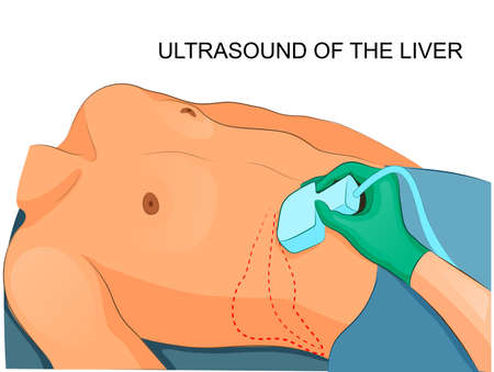 vector illustration of an ultrasound of the liver.のイラスト素材