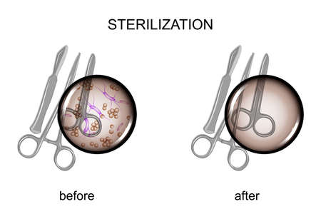 Vector illustration of surgical instruments before and after sterilizationのイラスト素材