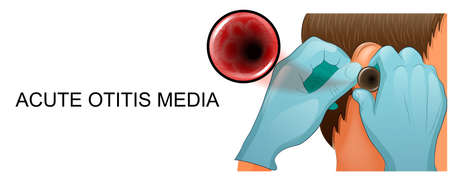 vector illustration of the study of the ear in otolaryngology.のイラスト素材