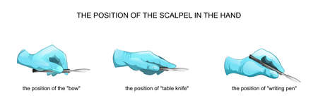 Vector illustration of the position of the scalpel in the handのイラスト素材