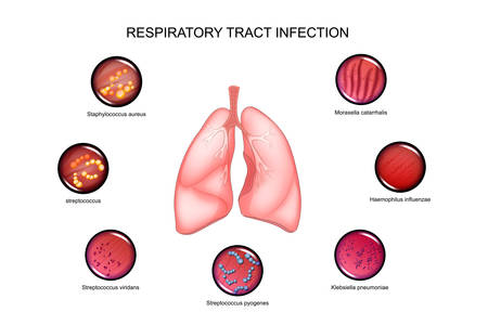 vector illustration of lungs and respiratory tract infections.のイラスト素材