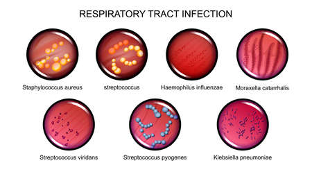 vector illustration of respiratory tract infections, microbiology, bacteriology.のイラスト素材